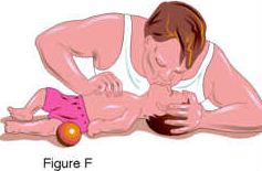 Figure F: Mouth-to-mouth resuscitation of an infant